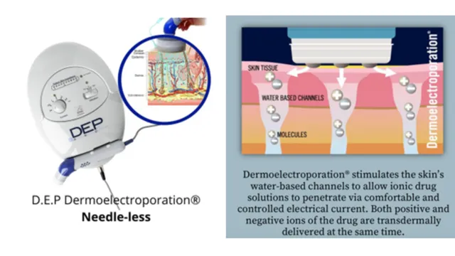 A close-up of a hand holding a device with D.E.P DEP mesotherapy Technology improve 17x deeper penetration of skin booster with calibrated depth of 1mm to hypodermis or subcutaneous tissue