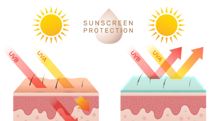 Importance of Sunscreen