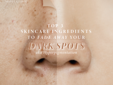 Top 3 Skincare Ingredients to Fade Dark Spots