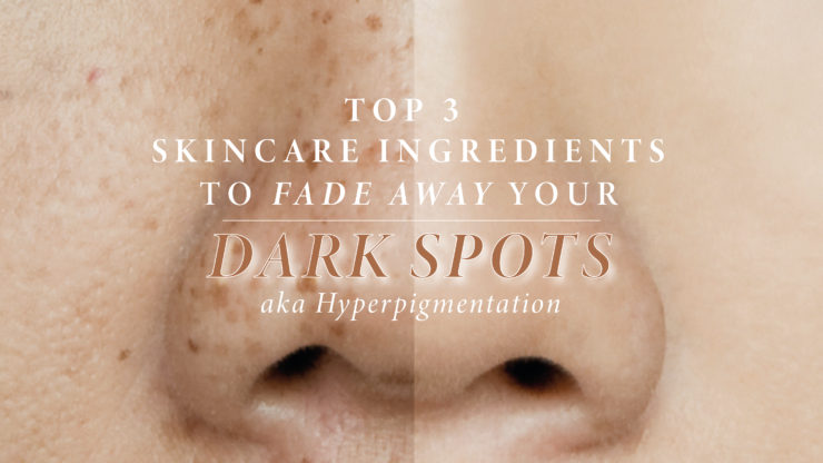 Top 3 Skincare Ingredients to Fade Dark Spots