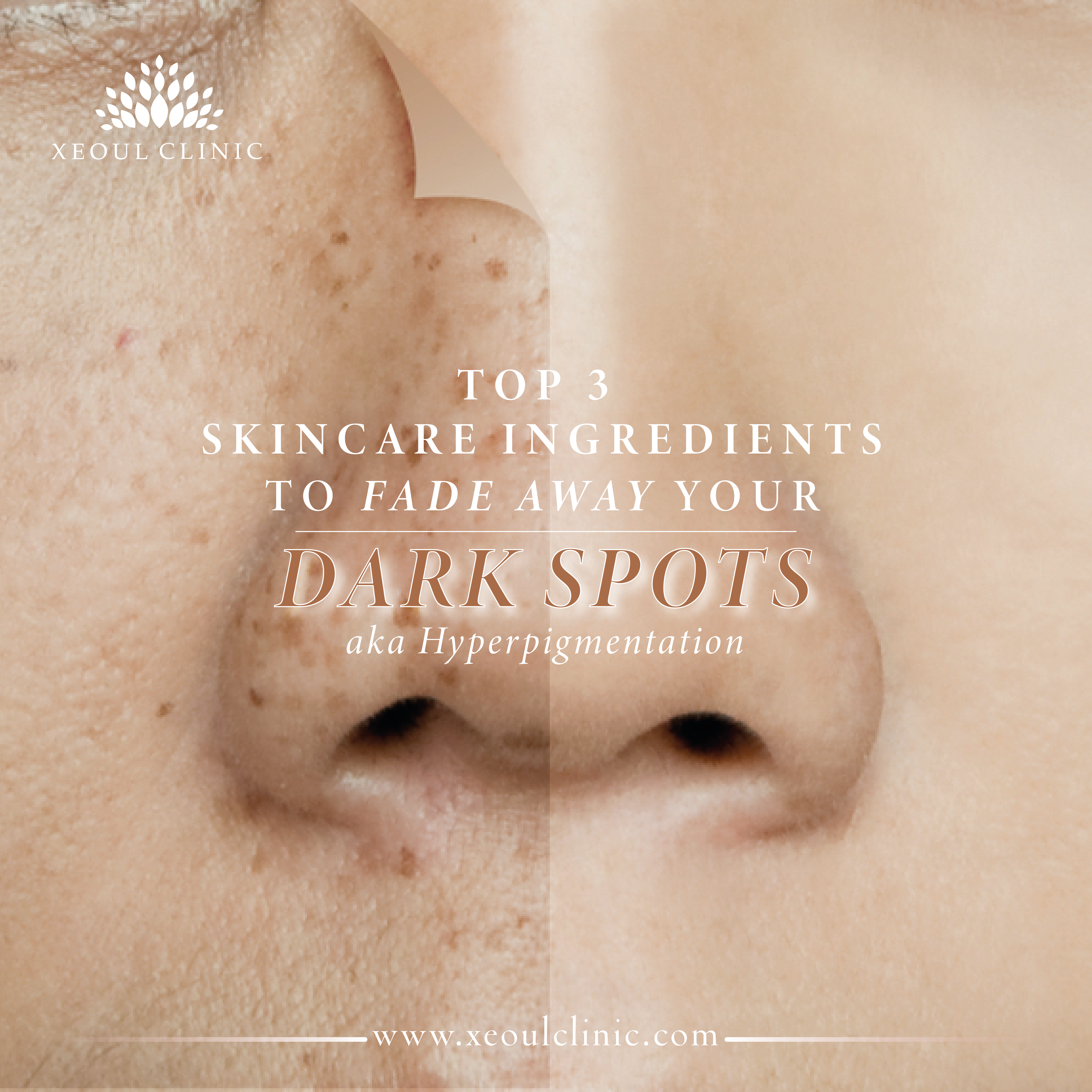 top-3-skincare-ingredients-to-fade-dark-spots-xeoul-clinic