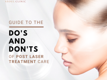 Do and Don’t after laser treatment
