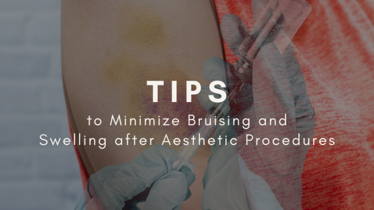 Tips to Minimize Bruising and Swelling after Aesthetic Procedures