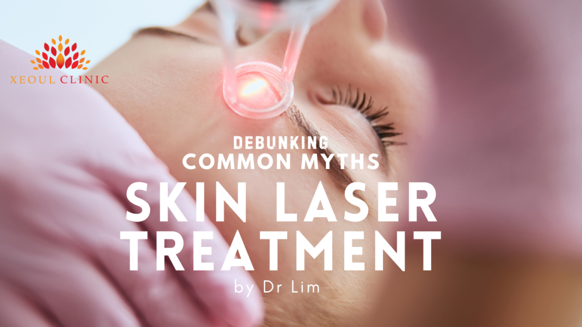 Debunking Common Myths about Skin Laser Treatments