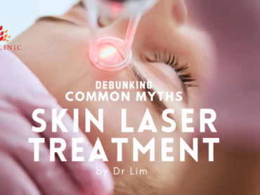 Debunking Common Myths about Skin Laser Treatments