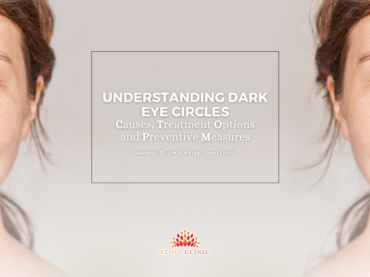 Understanding Dark Eye Circles: causes, treatments and preventive measures