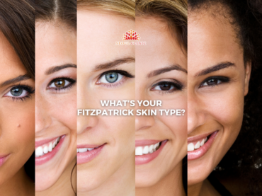 What’s your Fitzpatrick skin type?