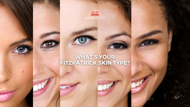 What’s your Fitzpatrick skin type?