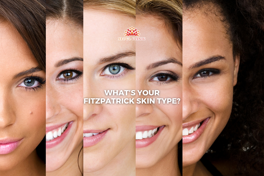 What’s your Fitzpatrick skin type?