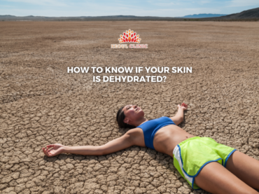 Sign of dehydrated skin