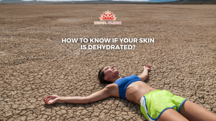 Sign of dehydrated skin