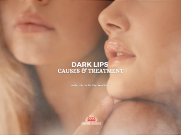 Understanding Dark Lips: Causes and How Lip Laser Treatment Can Help