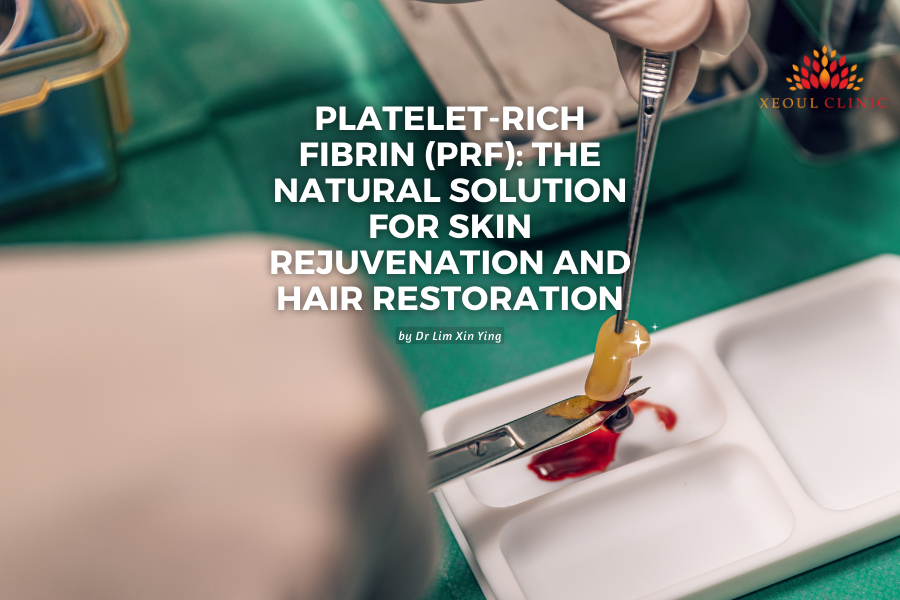 Platelet-Rich Fibrin (PRF): The Natural Solution for Skin Rejuvenation and Hair Restoration