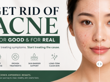 Get rid of acne for good and for real at Subang Jaya Xeoul Clinic